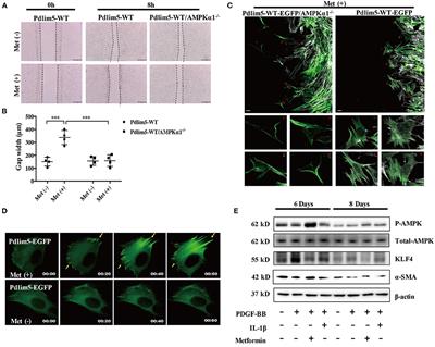 Metformin Suppresses the Progress of Diabetes-Accelerated Atherosclerosis by Inhibition of Vascular Smooth Muscle Cell Migration Through AMPK–Pdlim5 Pathway